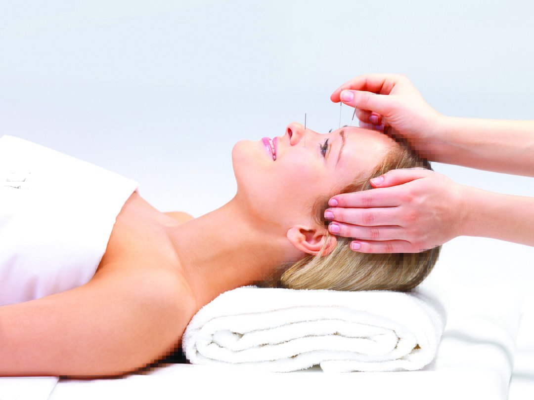 AZ Acupuncture - AZ Acupuncture