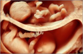 Babybond & Ultrasound Direct Manchester - Babybond & Ultrasound Direct Manchester