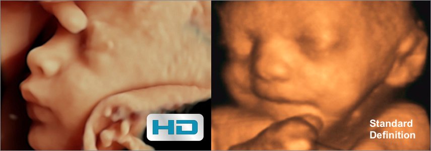 Babybond & Ultrasound Direct Manchester - Babybond & Ultrasound Direct Manchester