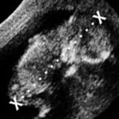 Babybond & Ultrasound Direct Manchester - Babybond & Ultrasound Direct Manchester