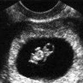 Babybond & Ultrasound Direct Manchester - Babybond & Ultrasound Direct Manchester