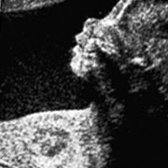 Babybond & Ultrasound Direct Manchester - Babybond & Ultrasound Direct Manchester