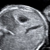 Babybond & Ultrasound Direct Manchester - Babybond & Ultrasound Direct Manchester