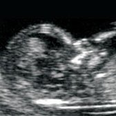 Babybond & Ultrasound Direct Manchester - Babybond & Ultrasound Direct Manchester