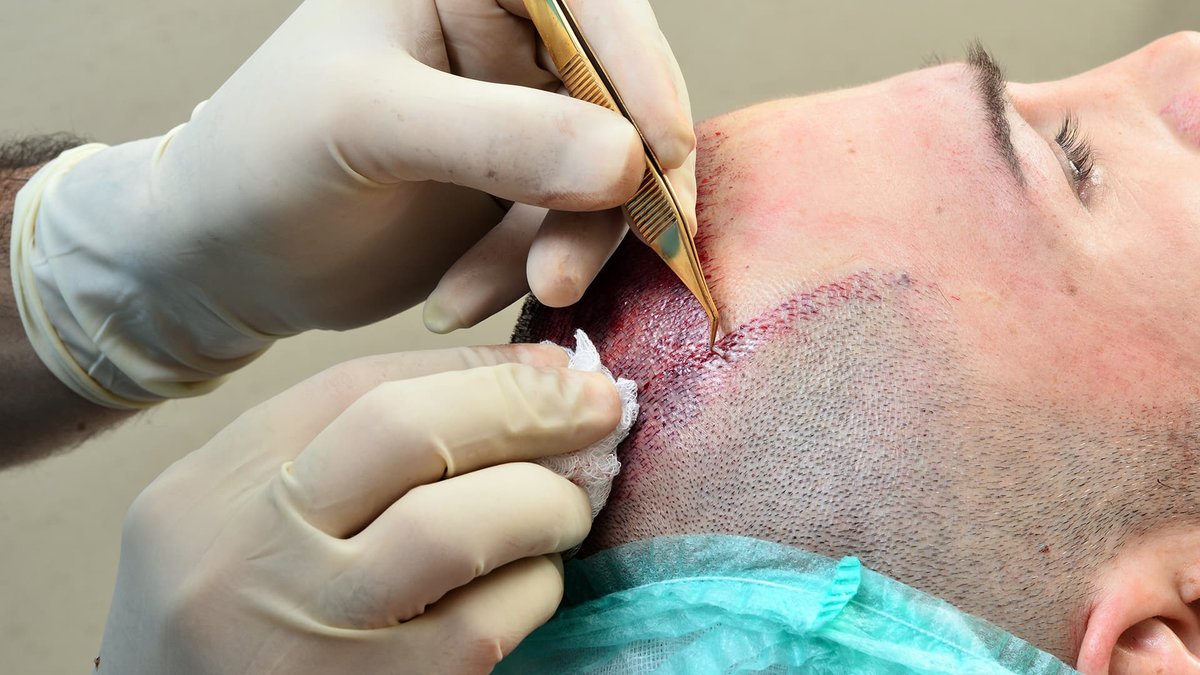 مركز باداي للشعر - Baday Hair Center
