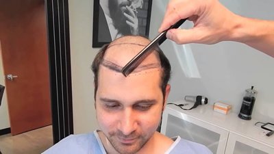 مركز باداي للشعر - Baday Hair Center