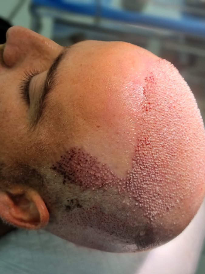 مركز باداي للشعر - Baday Hair Center