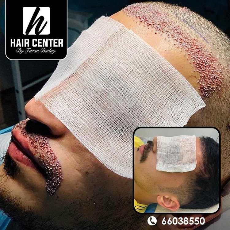 مركز باداي للشعر - Baday Hair Center