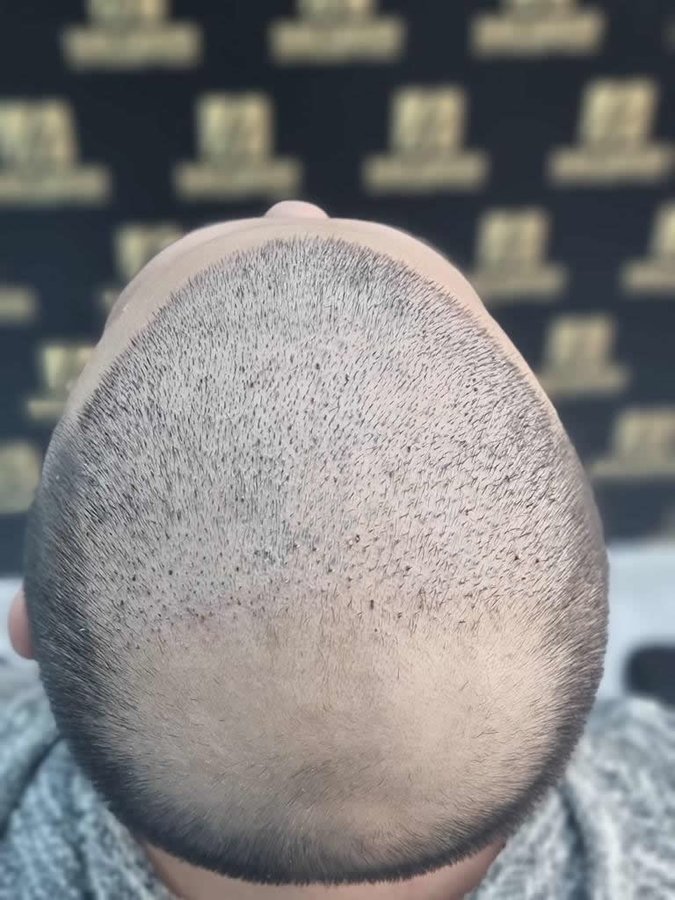 مركز باداي للشعر - Baday Hair Center