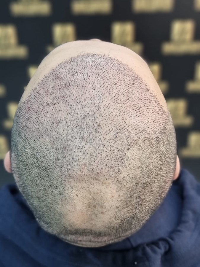 مركز باداي للشعر - Baday Hair Center