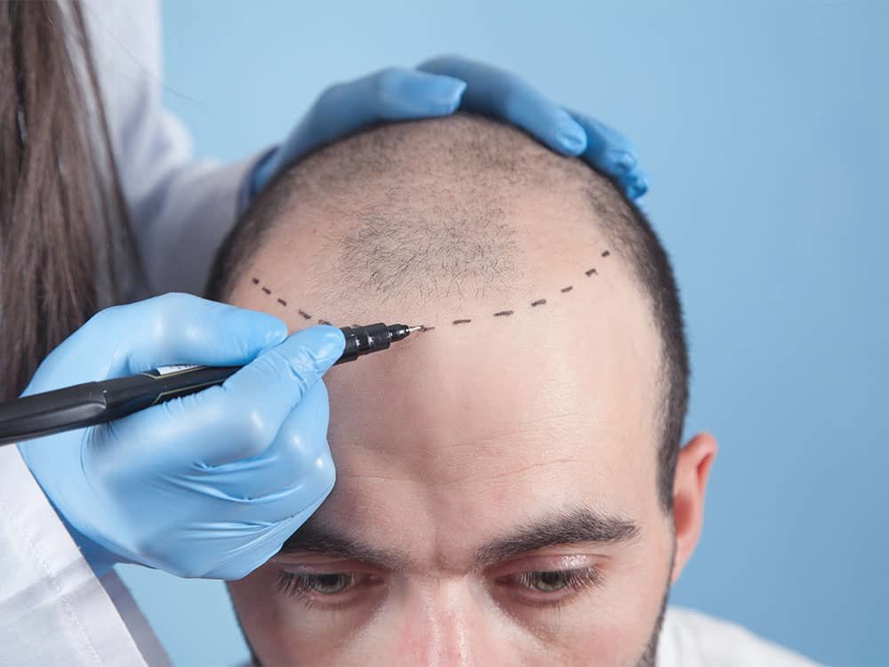 مركز باداي للشعر - Baday Hair Center