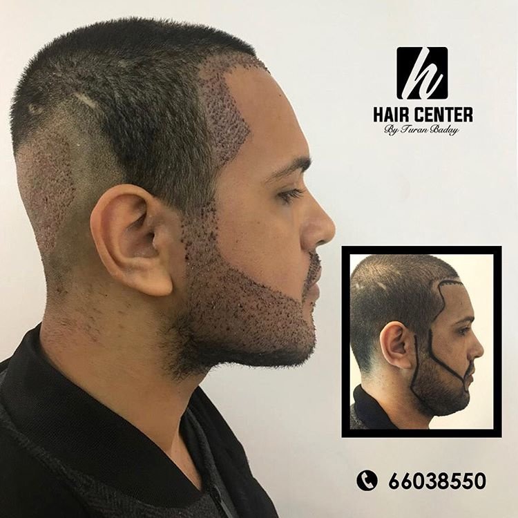 مركز باداي للشعر - Baday Hair Center