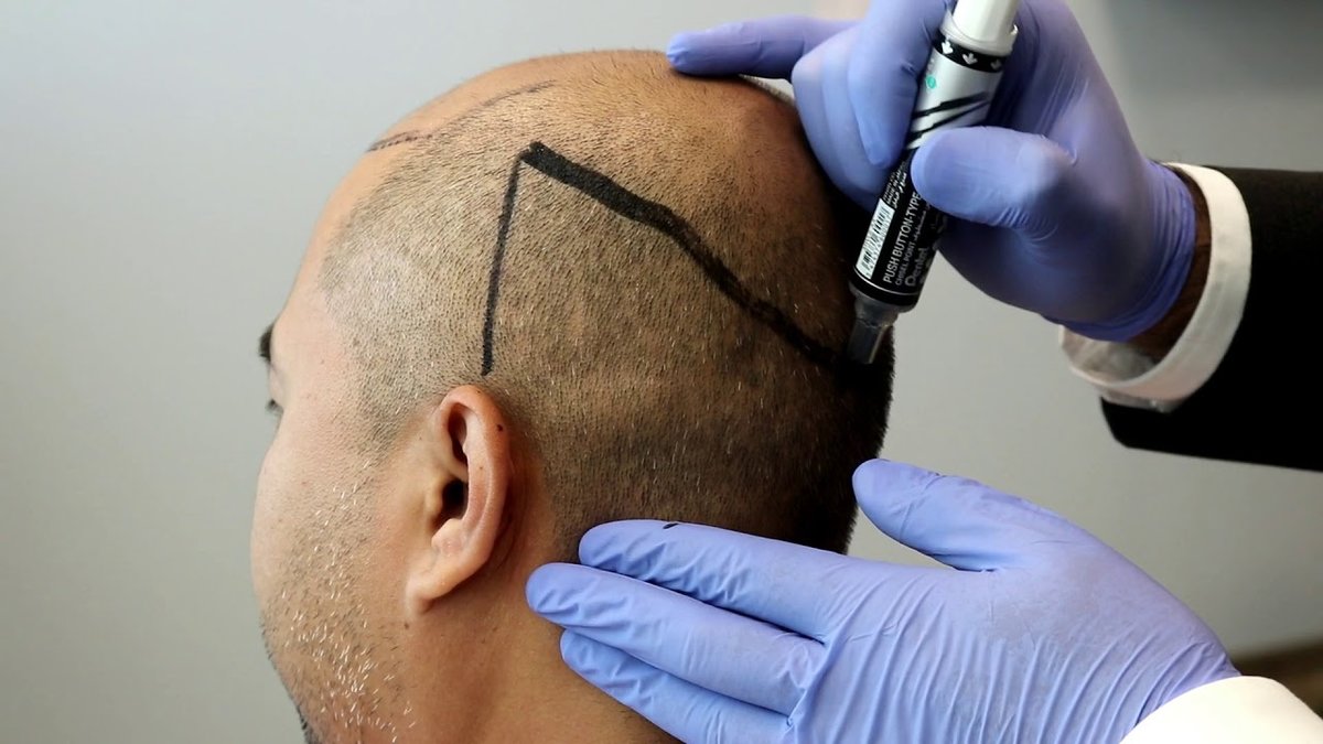 مركز باداي للشعر - Baday Hair Center