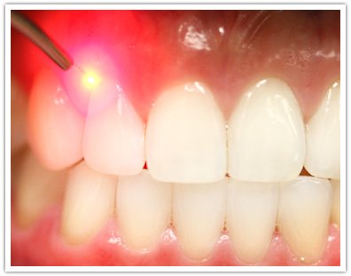 عيادة بالا لطب الأسنان - Bala Dental Clinic