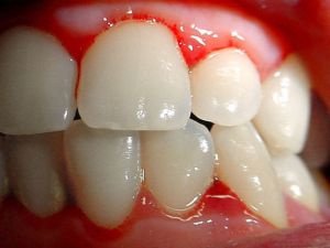 عيادة بالا لطب الأسنان - Bala Dental Clinic