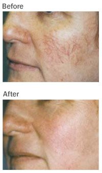 Balance Medi-Spa - Balance Medi-Spa