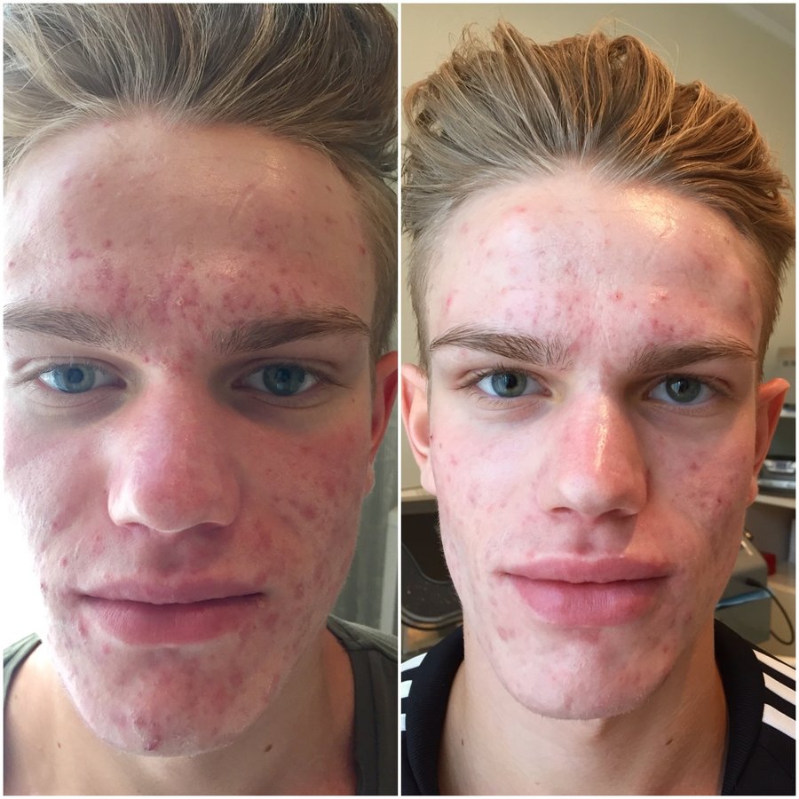 Baltic Beauty Pro - Baltic Beauty Pro