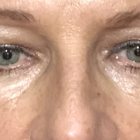 Bangkok Plastic Surgery Clinic - Bangkok Plastic Surgery Clinic