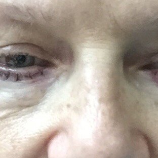 Bangkok Plastic Surgery Clinic - Bangkok Plastic Surgery Clinic