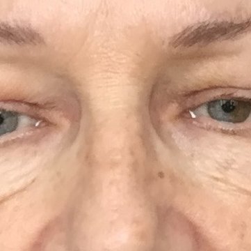 Bangkok Plastic Surgery Clinic - Bangkok Plastic Surgery Clinic