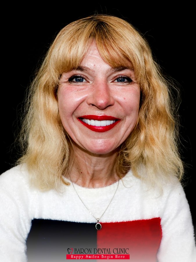 Baron Dental Clinic / Dental Tourism Antalya - Baron Dental Clinic / Dental Tourism Antalya