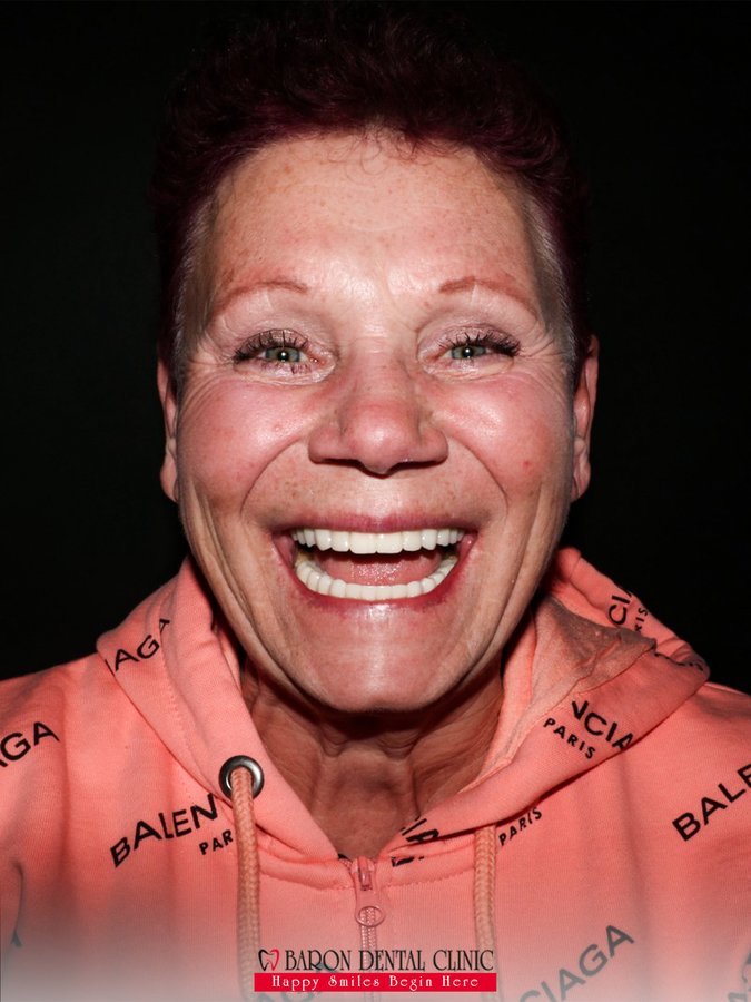 Baron Dental Clinic / Dental Tourism Antalya - Baron Dental Clinic / Dental Tourism Antalya