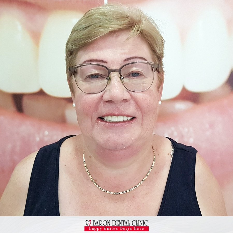 Baron Dental Clinic / Dental Tourism Antalya - Baron Dental Clinic / Dental Tourism Antalya