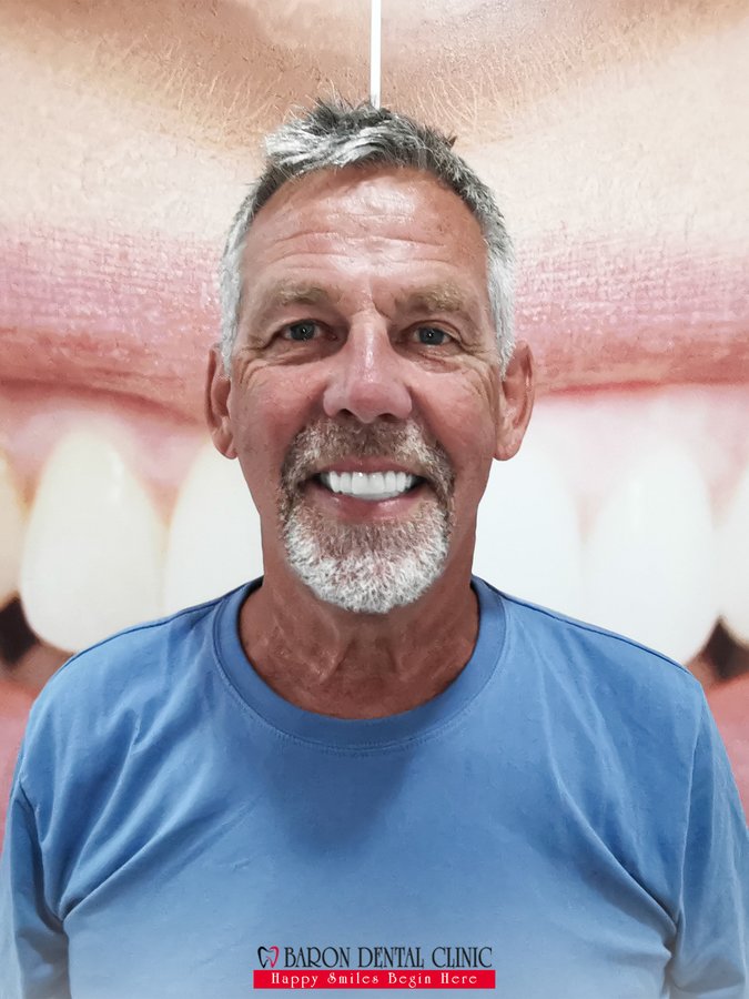 Baron Dental Clinic / Dental Tourism Antalya - Baron Dental Clinic / Dental Tourism Antalya