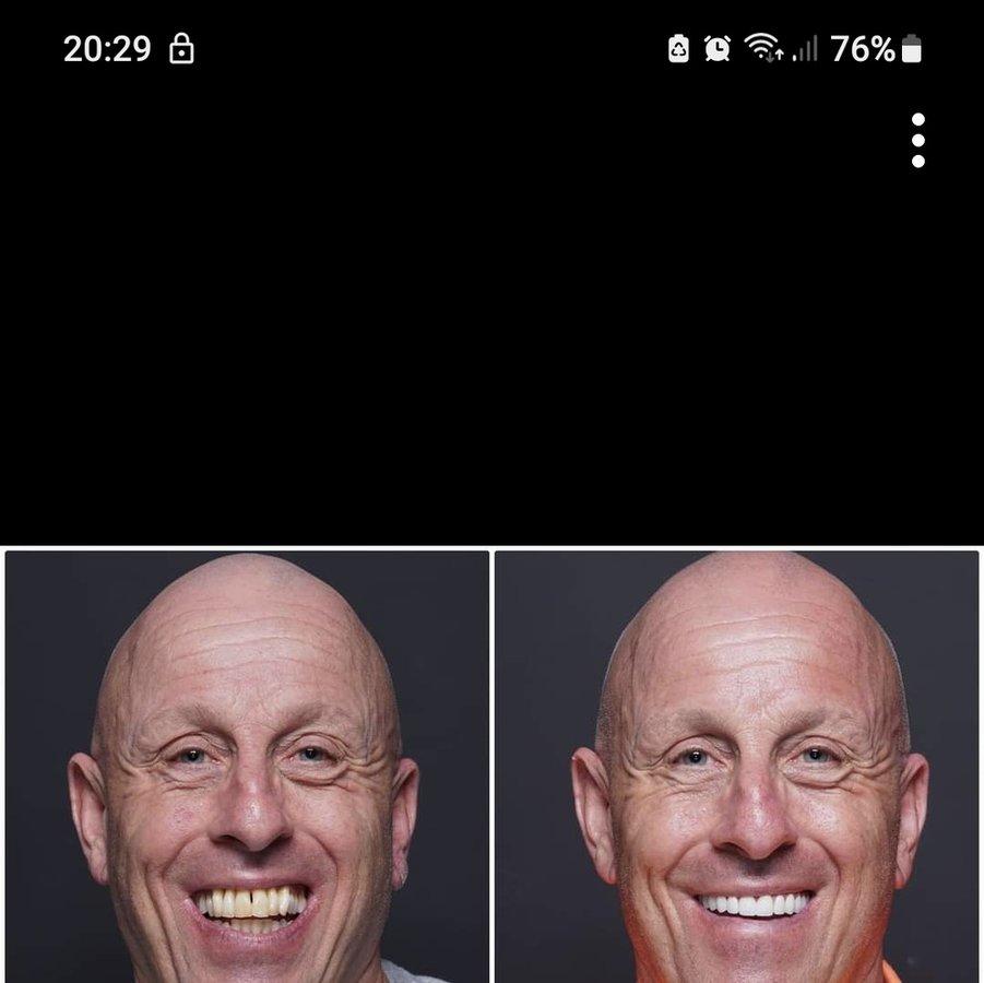 Baron Dental Clinic / Dental Tourism Antalya - Baron Dental Clinic / Dental Tourism Antalya