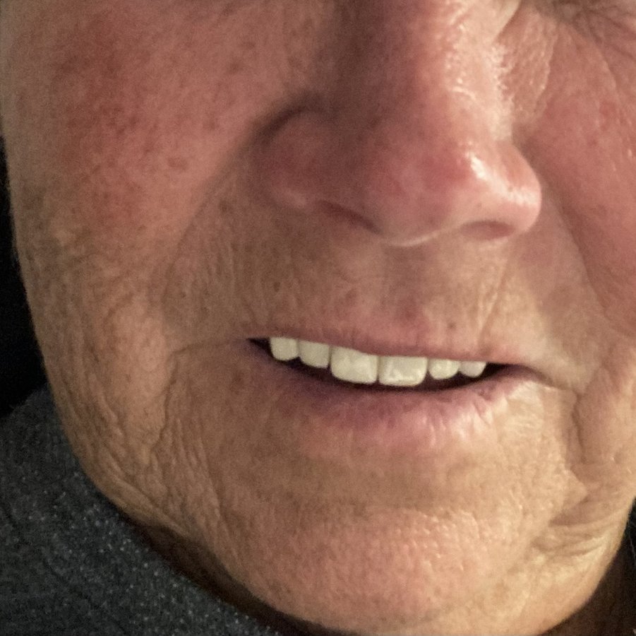 Baron Dental Clinic / Dental Tourism Antalya - Baron Dental Clinic / Dental Tourism Antalya