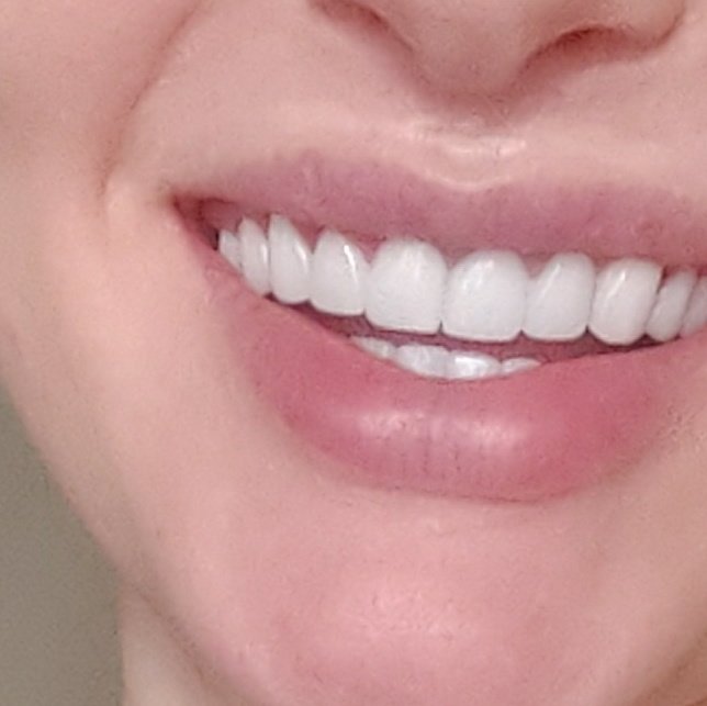 Baron Dental Clinic / Dental Tourism Antalya - Baron Dental Clinic / Dental Tourism Antalya