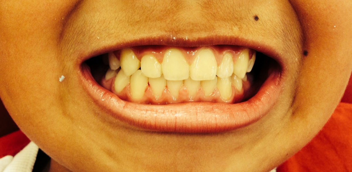 Basel's English-Swiss dentist, Dr Garry Bonsall - Basel's English-Swiss dentist, Dr Garry Bonsall