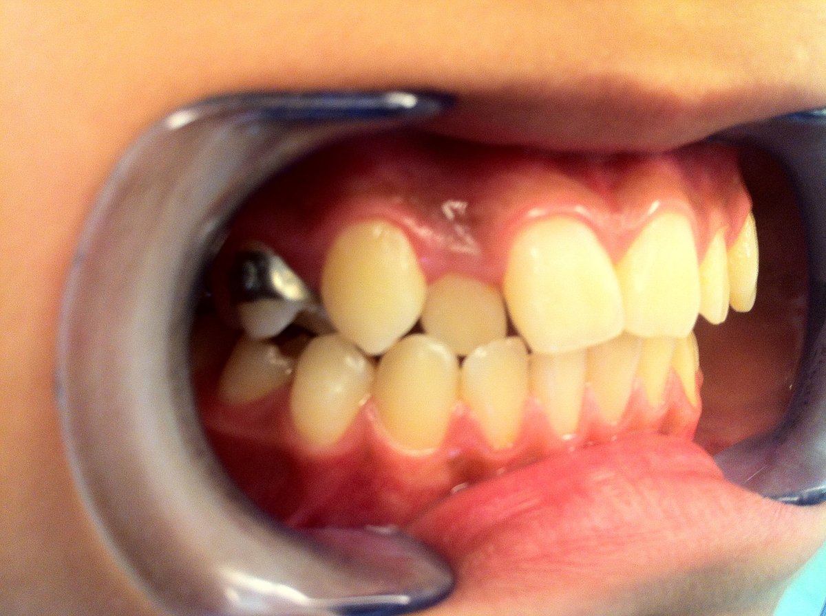 Basel's English-Swiss dentist, Dr Garry Bonsall - Basel's English-Swiss dentist, Dr Garry Bonsall