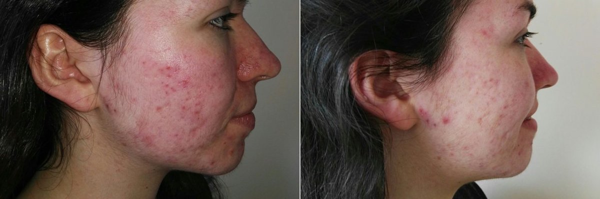 BE Pro Therapy - BE Pro Therapy