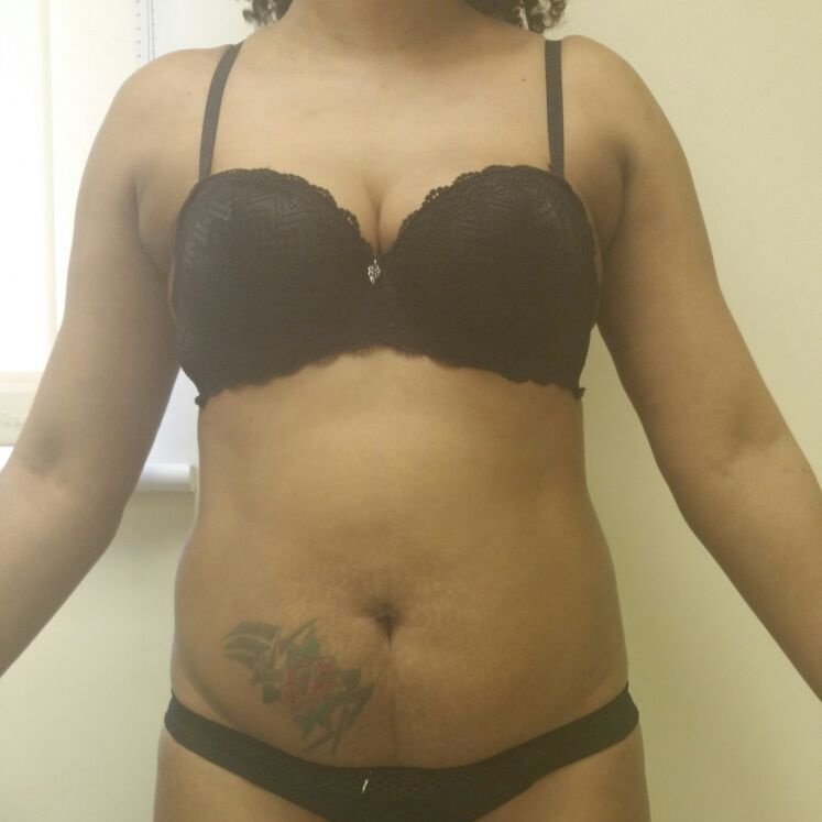 Beau Aesthetica Spa and Clinic - Beau Aesthetica Spa and Clinic