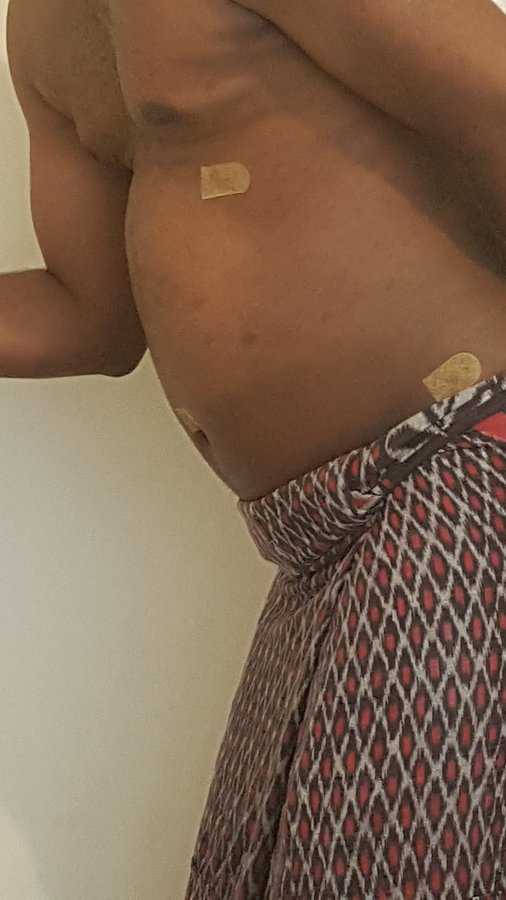 Beauty and FUE - Beauty and FUE