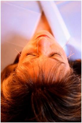 Bedford Acupuncture - Bedford Acupuncture