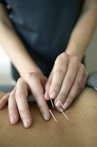 Bedford Acupuncture - Bedford Acupuncture