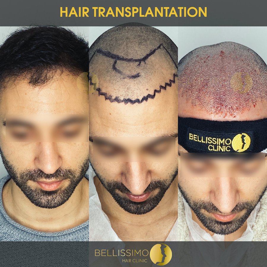 Bellissimo Hair Clinic - Bellissimo Hair Clinic