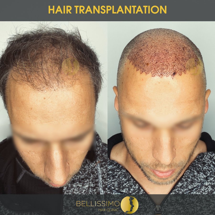 Bellissimo Hair Clinic - Bellissimo Hair Clinic