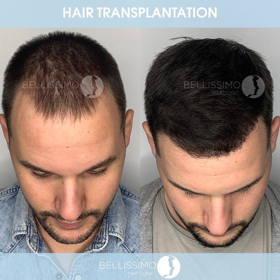 Bellissimo Hair Clinic - Bellissimo Hair Clinic