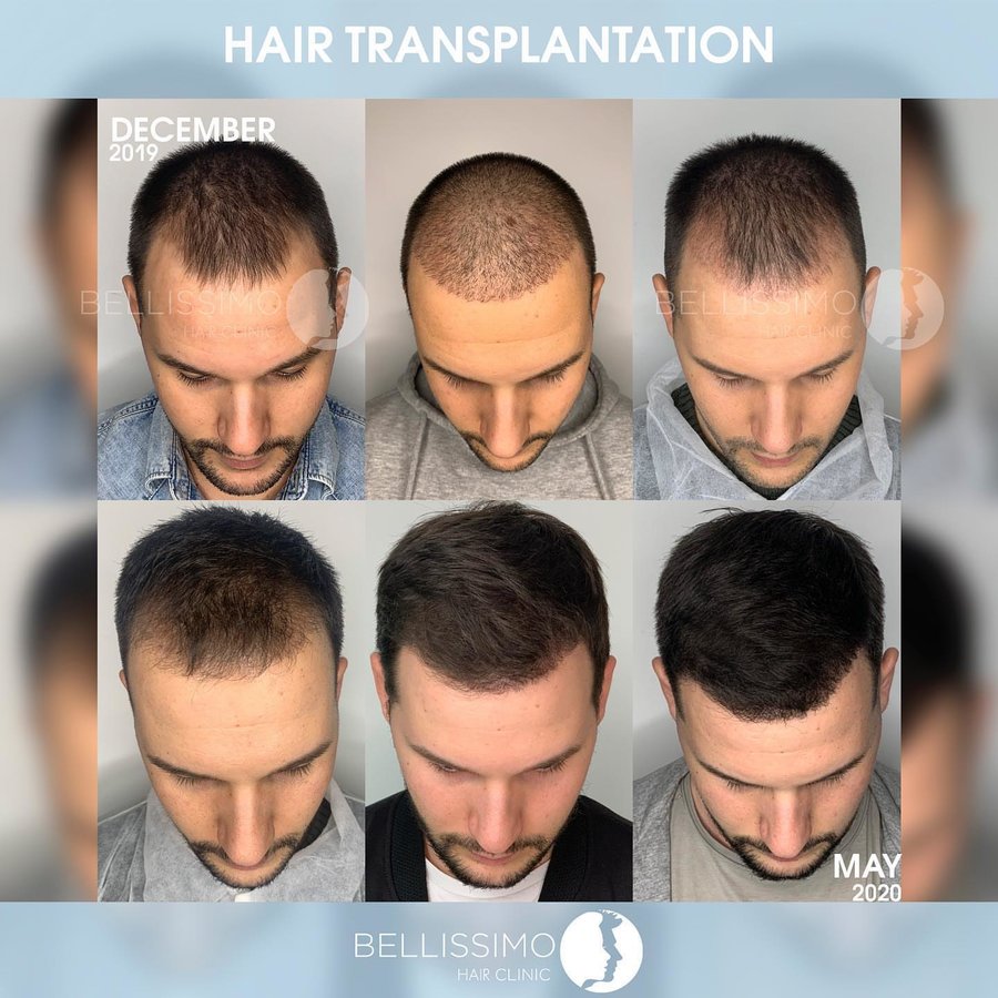 Bellissimo Hair Clinic - Bellissimo Hair Clinic