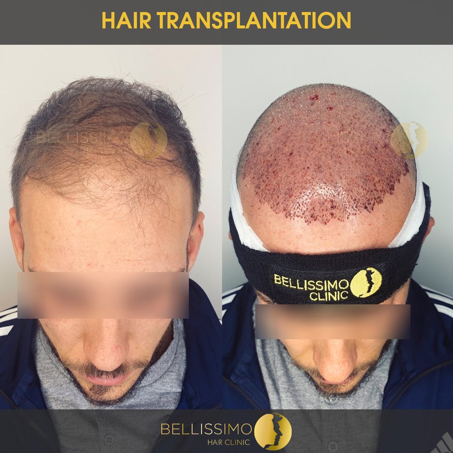 Bellissimo Hair Clinic - Bellissimo Hair Clinic