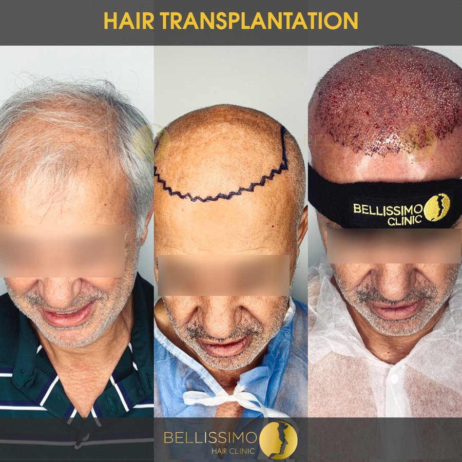 Bellissimo Hair Clinic - Bellissimo Hair Clinic
