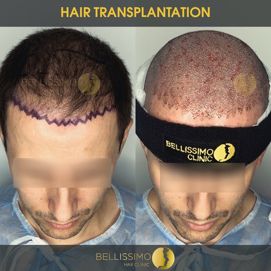 Bellissimo Hair Clinic - Bellissimo Hair Clinic