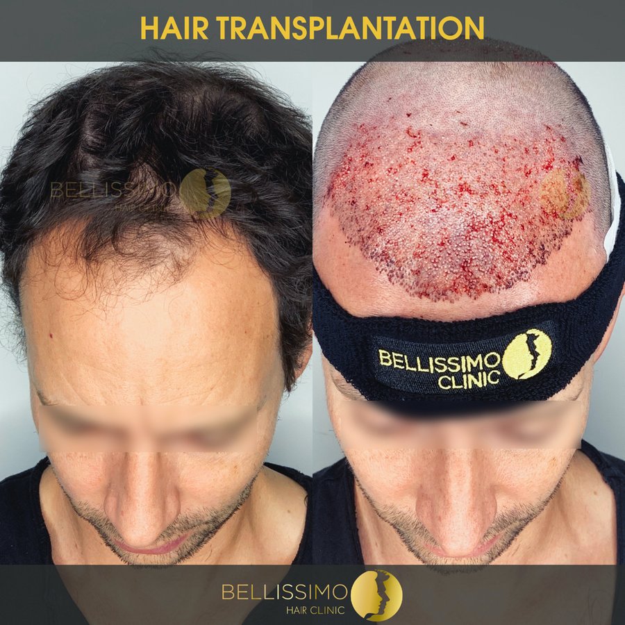 Bellissimo Hair Clinic - Bellissimo Hair Clinic