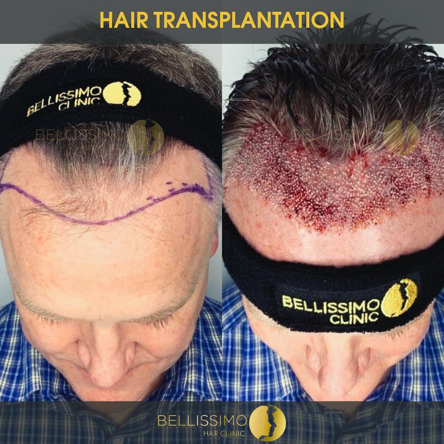 Bellissimo Hair Clinic - Bellissimo Hair Clinic