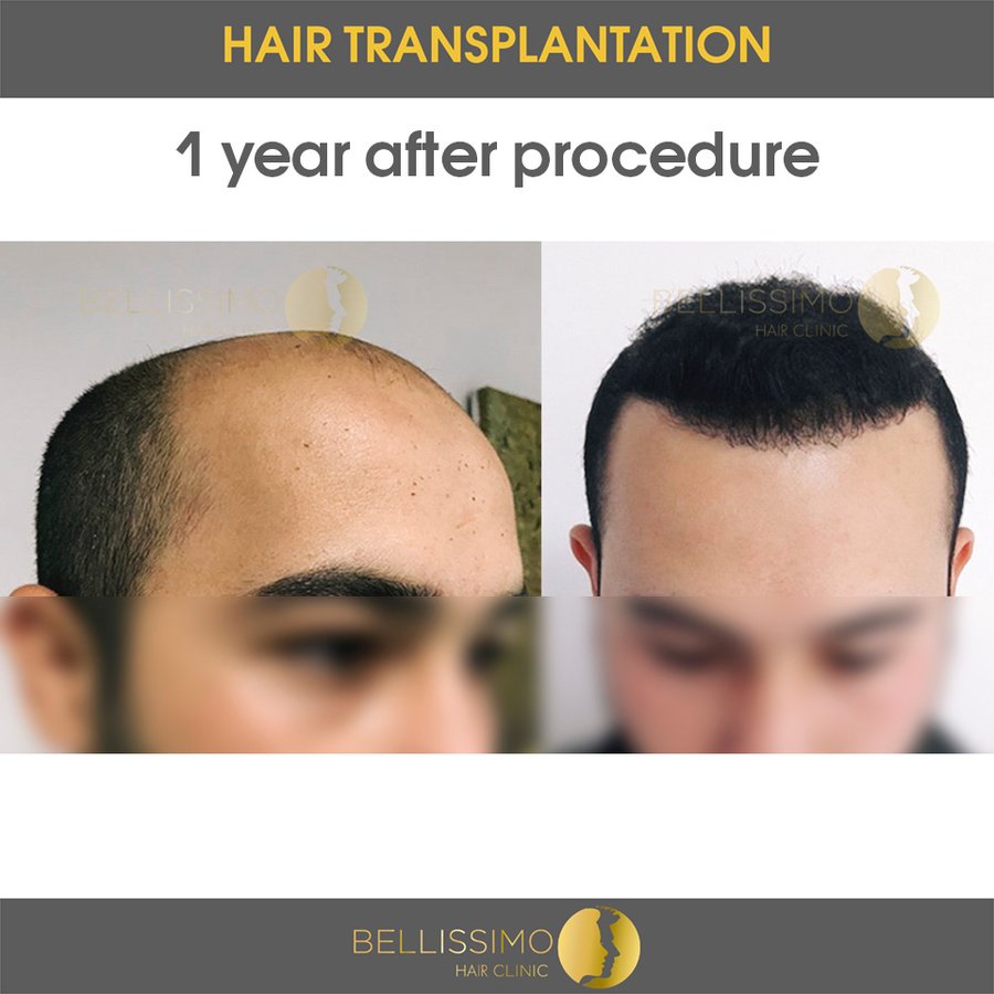 Bellissimo Hair Clinic - Bellissimo Hair Clinic
