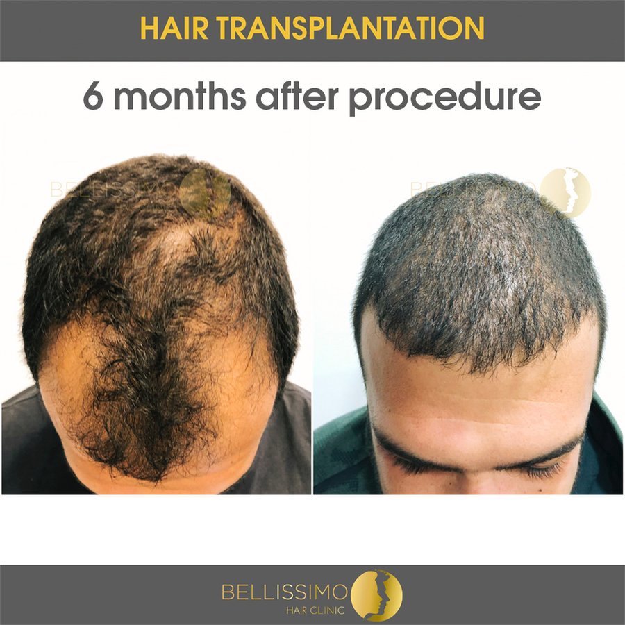 Bellissimo Hair Clinic - Bellissimo Hair Clinic