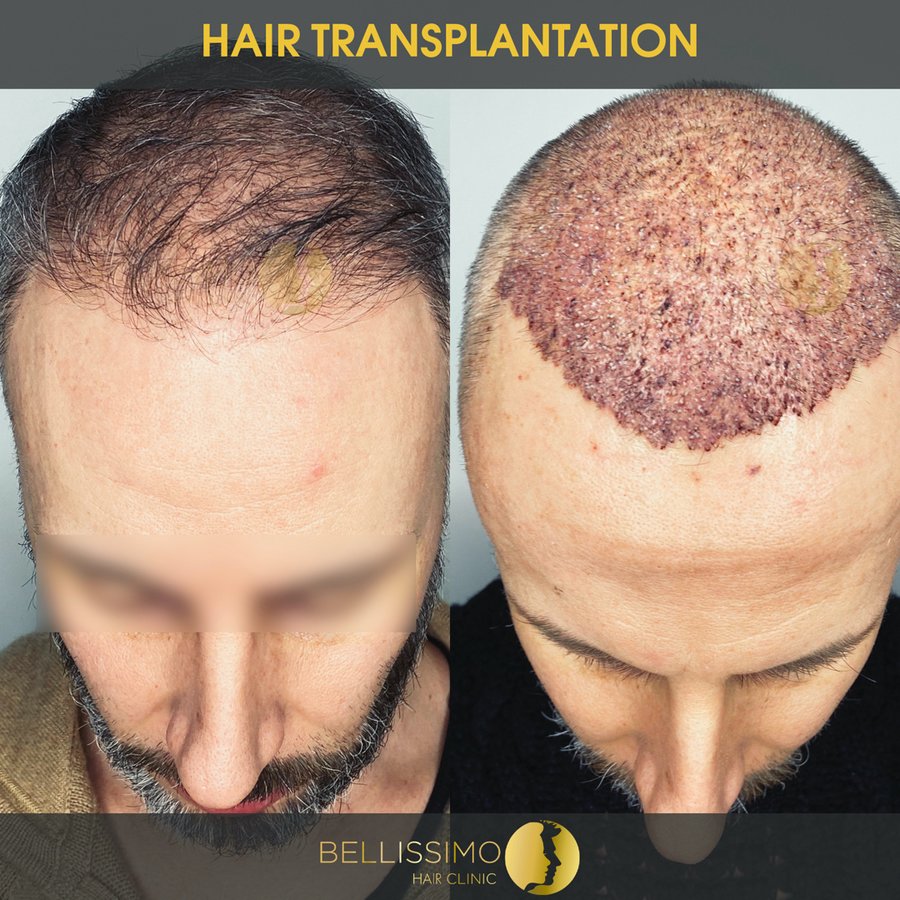 Bellissimo Hair Clinic - Bellissimo Hair Clinic
